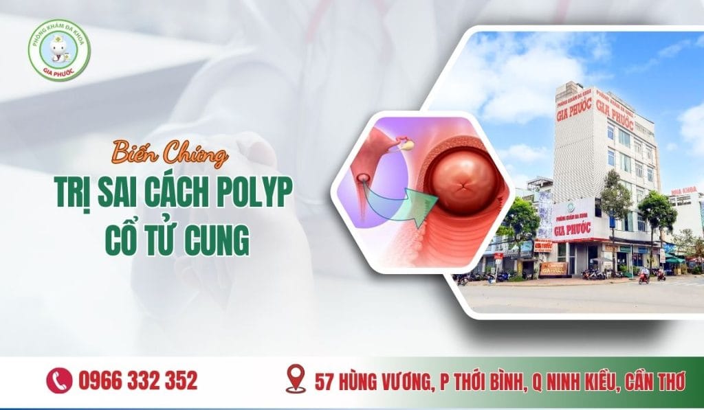 Biến Chứng Trị Sai Cách Polyp Cổ Tử Cung