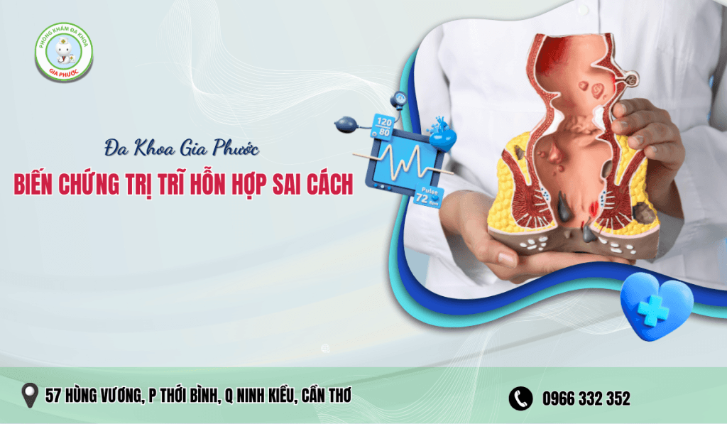 Biến Chứng Trị Trĩ Hỗn Hợp Sai Cách