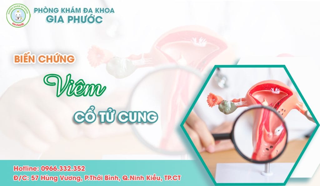 Biến chứng viêm cổ tử cung