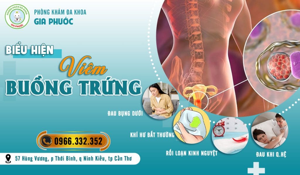 Biểu hiện viêm buồng trứng