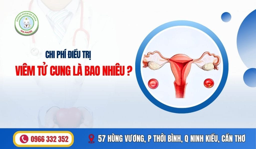 Chi Phí Điều Trị Viêm Tử Cung Là Bao Nhiêu