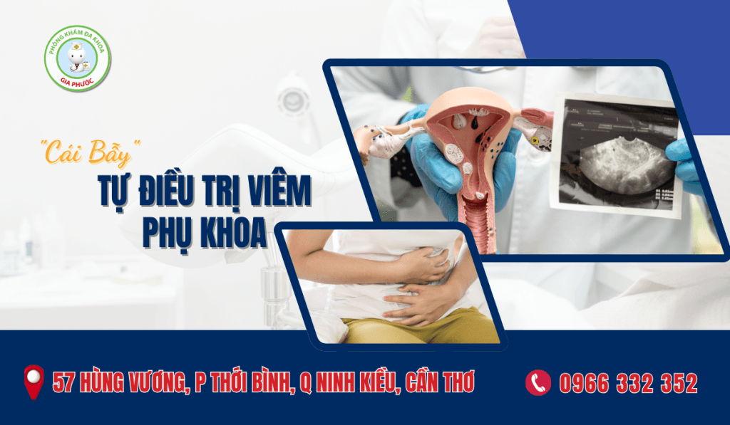 Hiểm Họa Điều Trị Viêm Phụ Khoa Tại Nhà - Những Cái Bẫy Nguy Hiểm Khi Tự Điều Trị Viêm Phụ Khoa