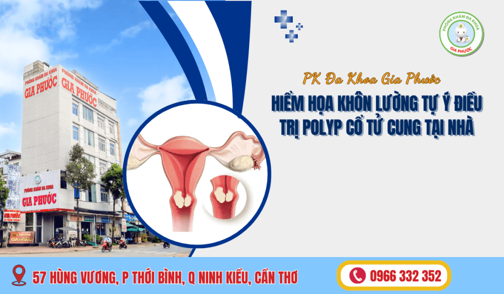 Hiểm Họa Khôn Lường Tự Ý Điều Trị Polyp Cổ Tử Cung Tại Nhà