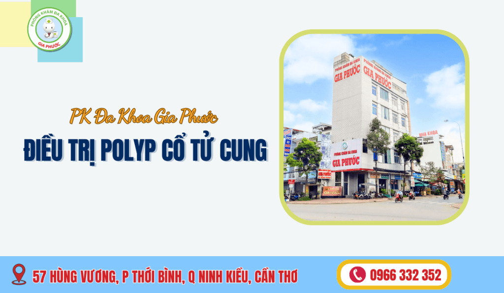 Điều Trị Polyp Cổ Tử Cung Uy Tín Tại Cần Thơ: Phòng Khám Đa Khoa Gia Phước