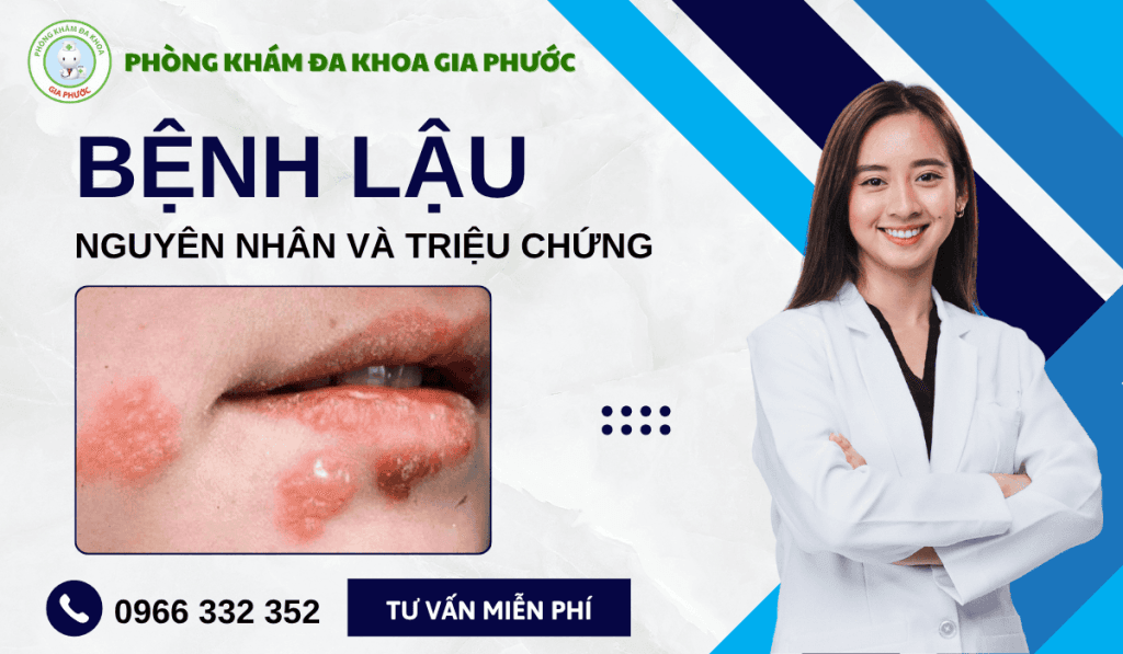 Bệnh lậu