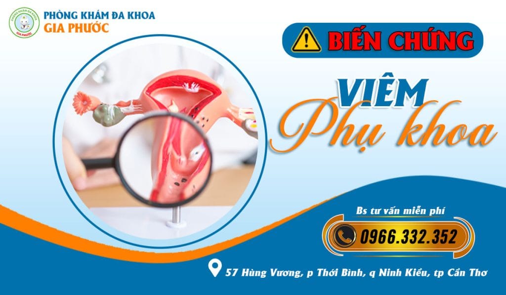 Biến chứng viêm phụ khoa nếu không điều trị sớm