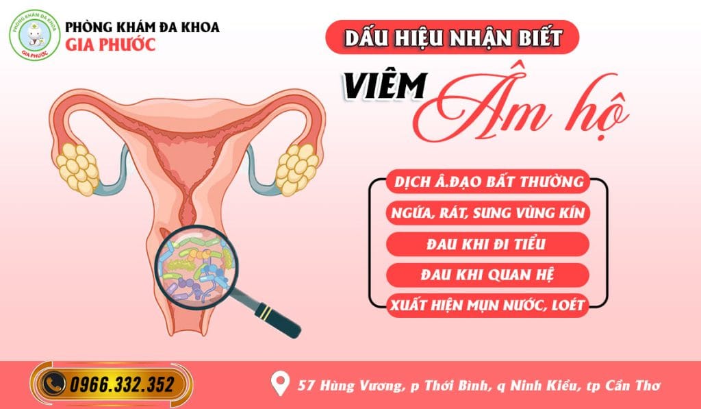 Dấu hiệu nhận biết bệnh viêm âm hộ ở nữ giới