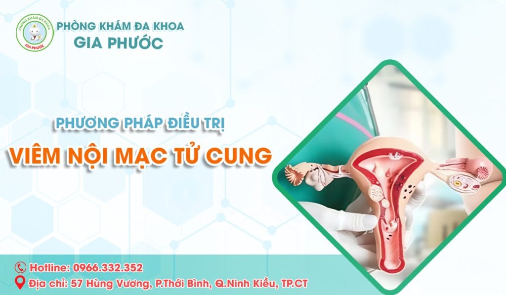 Phương pháp điều trị viêm nội mạc tử cung