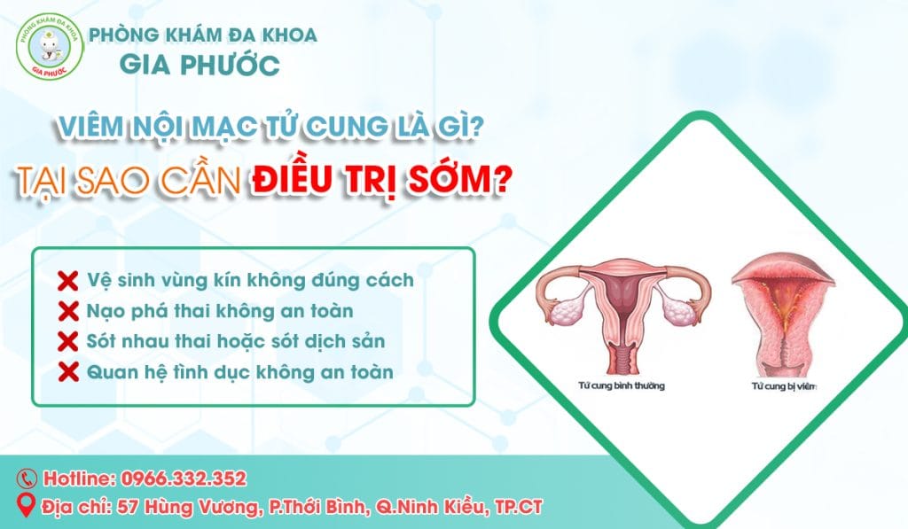 Viêm Nội Mạc Tử Cung Là Gì? Vì Sao Cần Điều Trị Sớm?