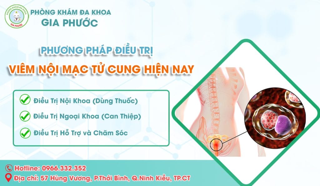 Các Phương Pháp Điều Trị Viêm Nội Mạc Tử Cung Hiện Nay