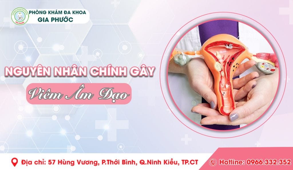 Nguyên Nhân Viêm Âm Đạo
