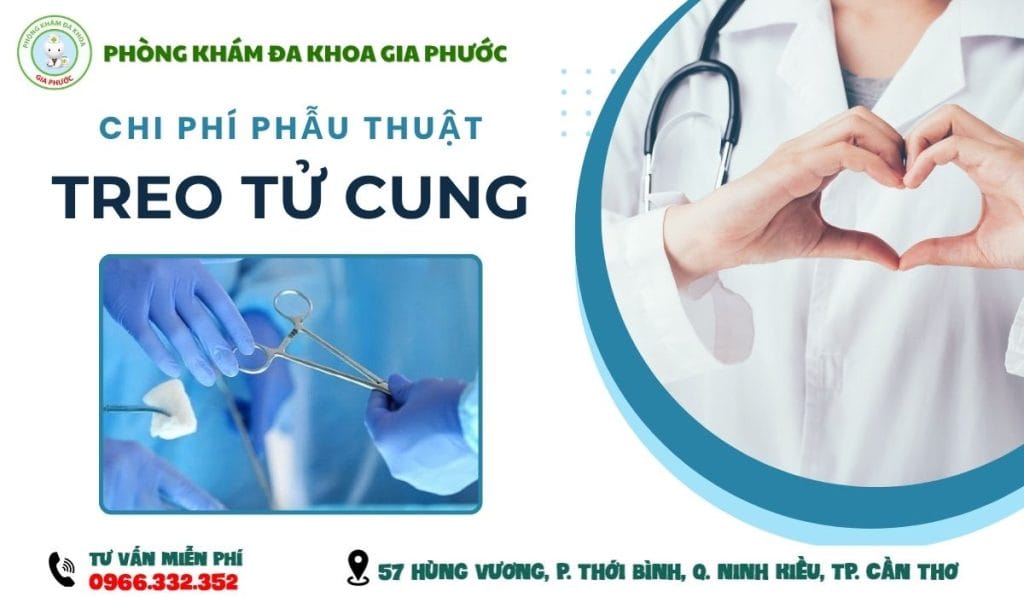 Chi Phí Phẫu Thuật Treo Tử Cung