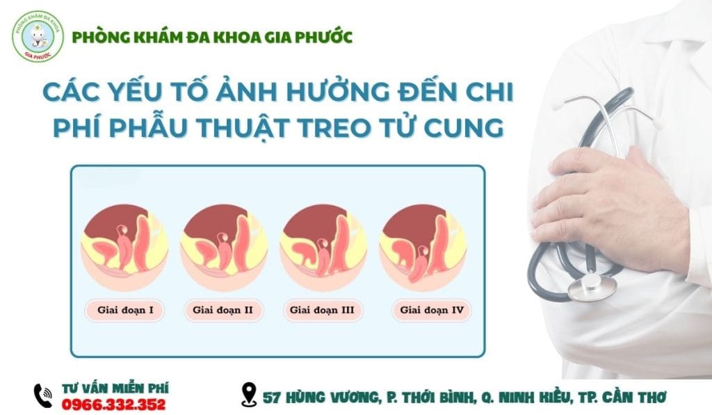 Chi phí phẫu thuật sa tử cung