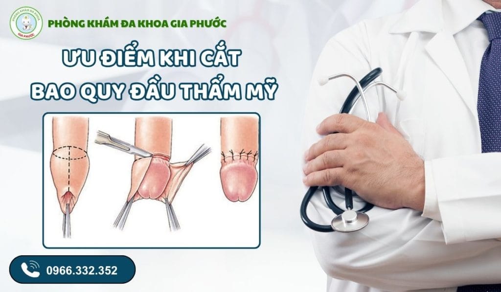 Địa chỉ cắt bao quy đầu thẩm mỹ