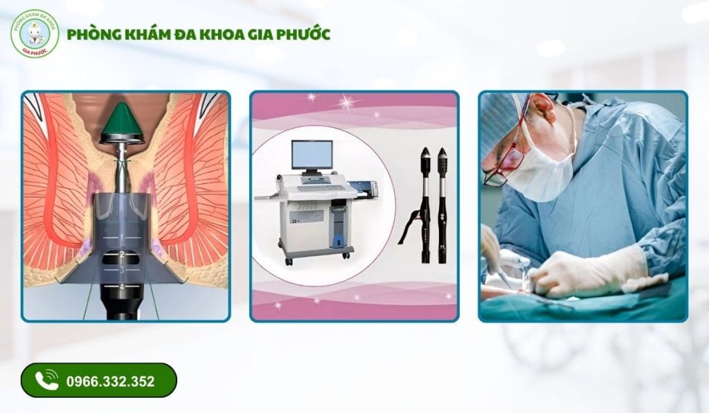 Phòng Khám Cắt Trĩ Uy Tín Tại Cần Thơ