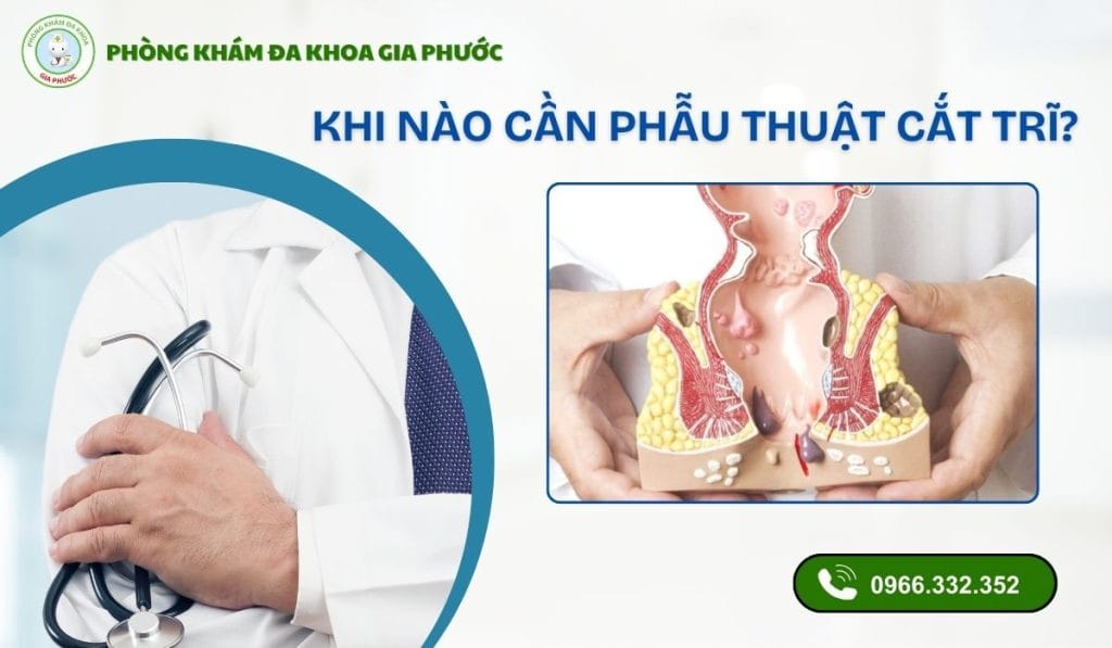 Phẫu thuật cắt trĩ ở đâu uy tín
