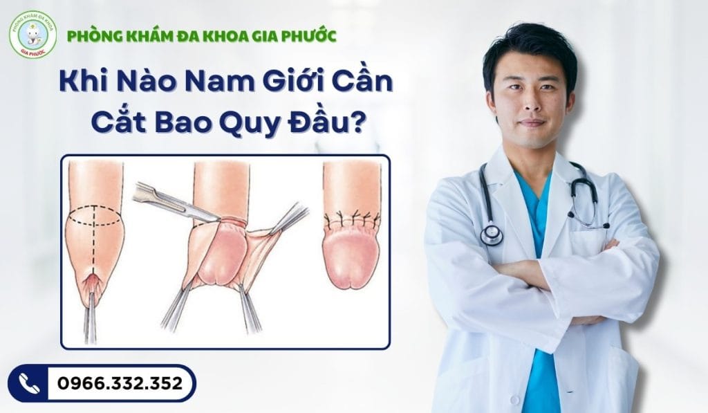 Cắt bao quy đầu tại vĩnh long