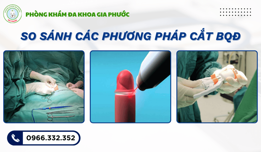 Cắt bao quy đầu tại sóc trăng