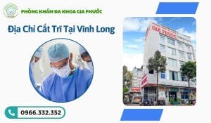 Địa Chỉ Cắt Trĩ Tại Vĩnh Long: Uy Tín, An Toàn Và Không Đau 82 Địa chỉ cắt trĩ tại vĩnh long
