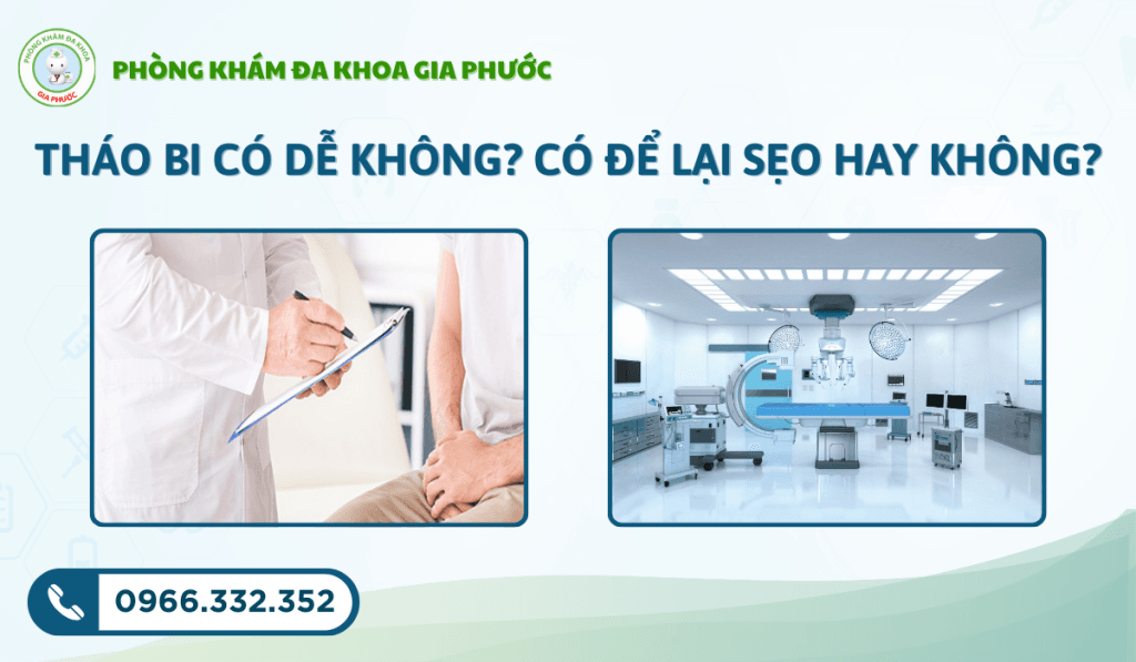 Gắn bi dương vật tại sóc trăng