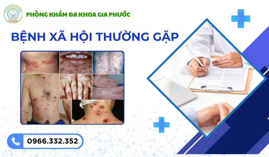 Điều trị bệnh xã hội ở trà vinh