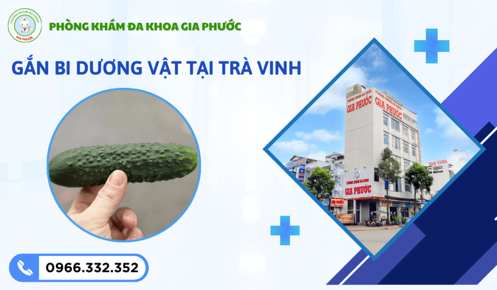 Tháo và Gắn Bi Dương Vật Tại Trà Vinh: Địa Chỉ Y Khoa An Toàn 1 Gắn bi dương vật tại trà vinh
