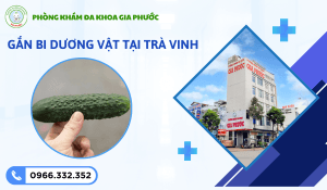 Tháo và Gắn Bi Dương Vật Tại Trà Vinh: Địa Chỉ Y Khoa An Toàn 10 Gắn bi dương vật tại trà vinh