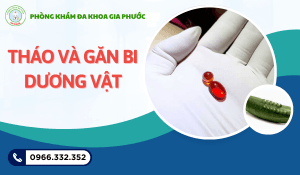 Tháo và Gắn Bi Dương Vật Tại Vĩnh Long: Hướng Dẫn Tìm Địa Chỉ Y Khoa An Toàn 19 Tháo và gắn bi dương vật tại vĩnh long