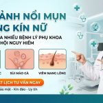 Hình ảnh nổi mụn ở vùng kín nữ