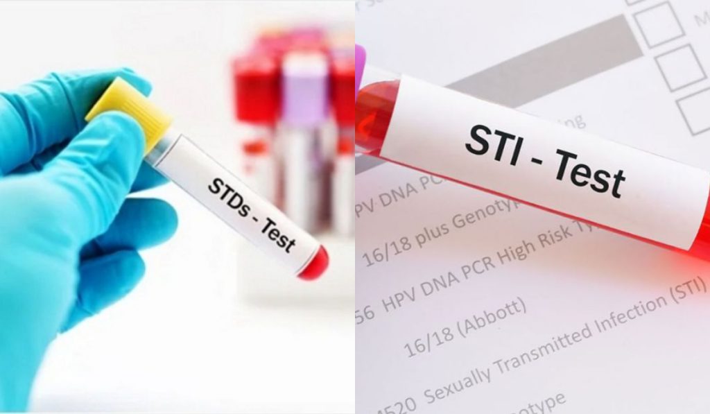 STD/STI là gì? Cách Phân Biệt Và Tìm Hiểu Tất Cả Bệnh Xã Hội Chi Tiết 5 Xét Nghiệm STD/STI Là Gì?