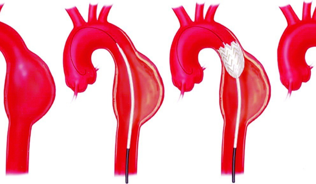 Các loại bệnh ngoại khoa khó chữa nhất