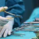 Chi phí cắt bao quy đầu bao nhiêu tiền