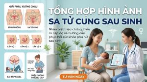 Tổng hợp hình ảnh sa tử cung sau sinh