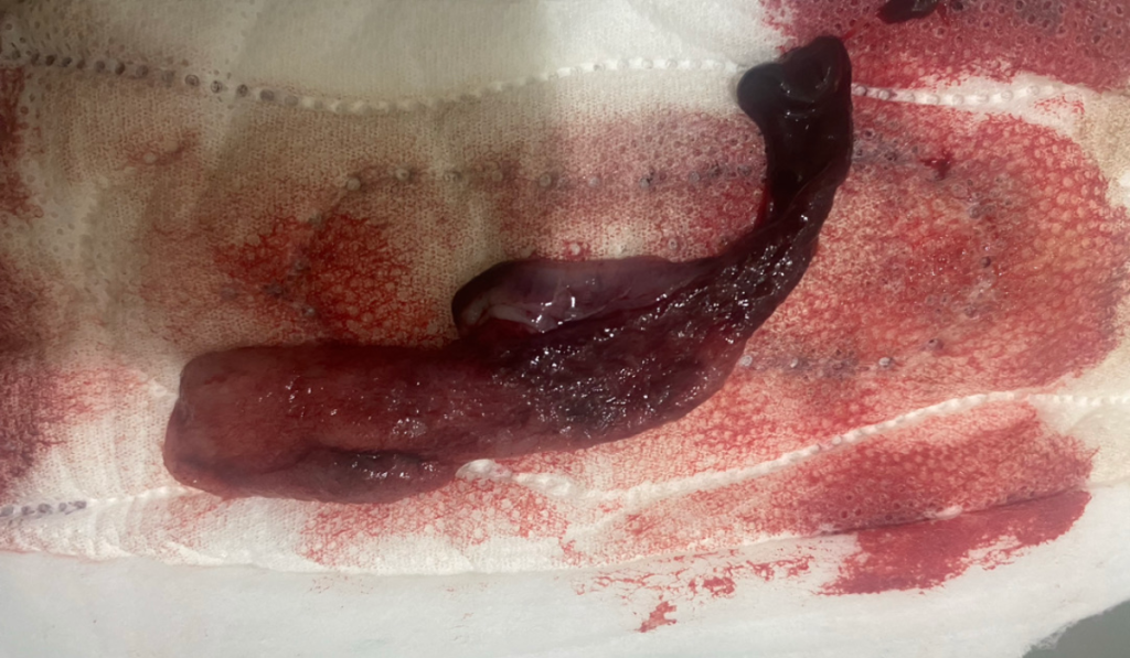 hinh anh kinh nguyet von cuc bat thuong