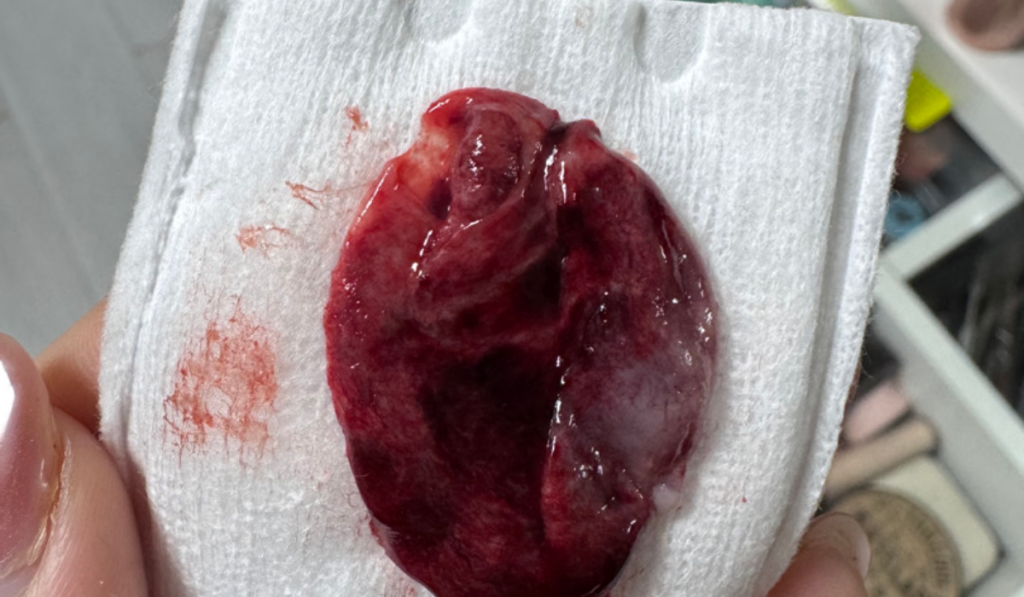 hinh anh kinh nguyet von cuc tai vung kin