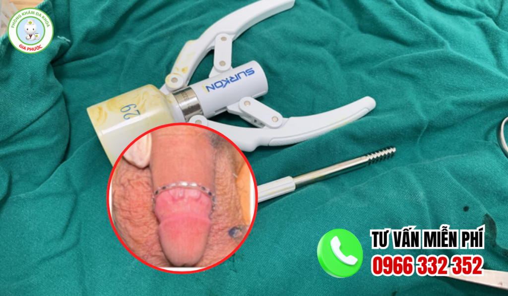 Hình ảnh sau khi cắt bao quy đầu 