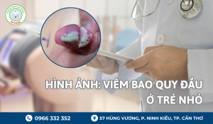 hình ảnh viêm bao quy đầu ở trẻ nhỏ