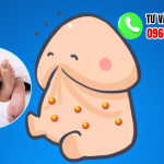 Tại sao đàn ông thích gắn bi