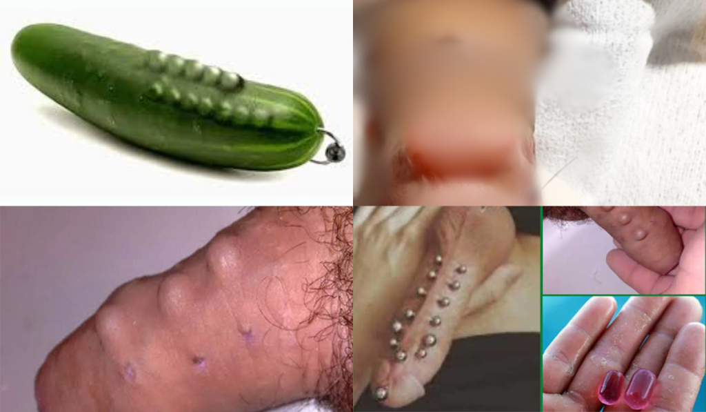 Hình ảnh gắn bi vào của quy nam giới