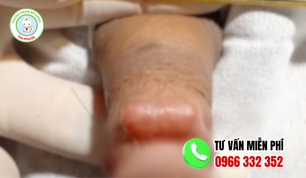 Hình Ảnh Gắn Bi Cho Nam Giới 