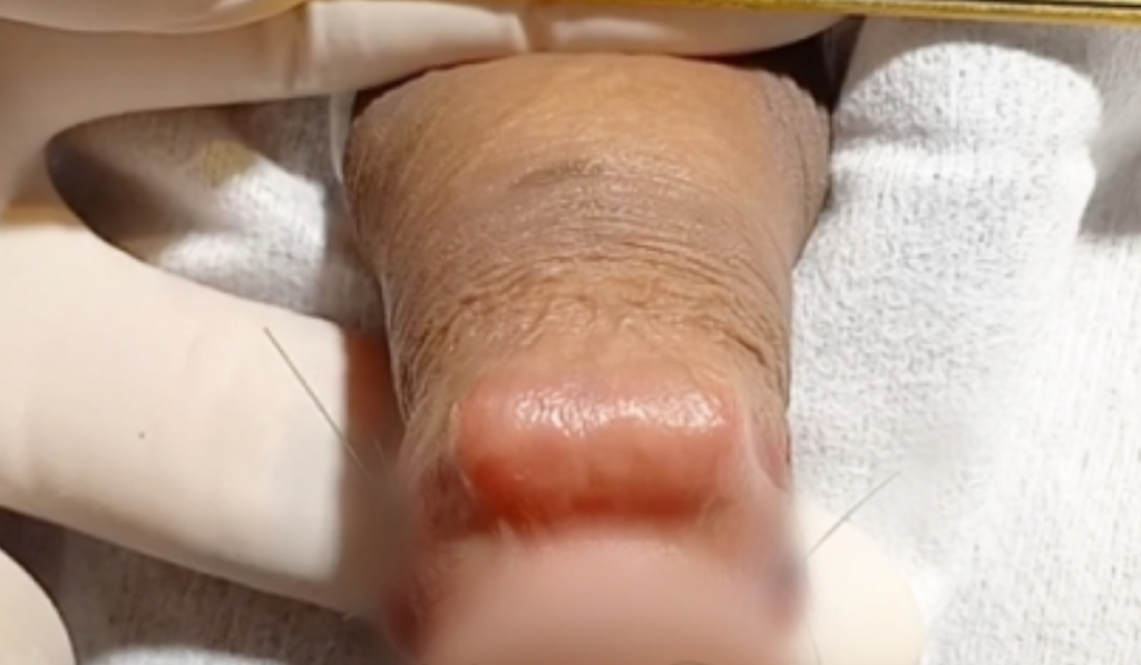 Hình ảnh gắn bi cho nam