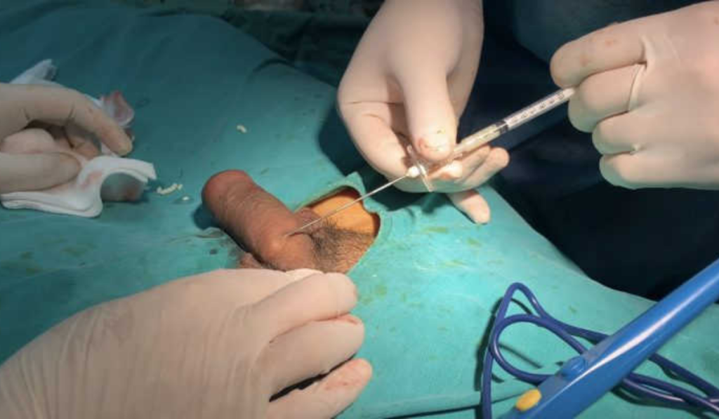 Hình ảnh gắn bi cho nam