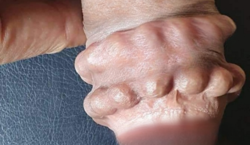 Hình Ảnh Gắn Bi Cho Nam Giới