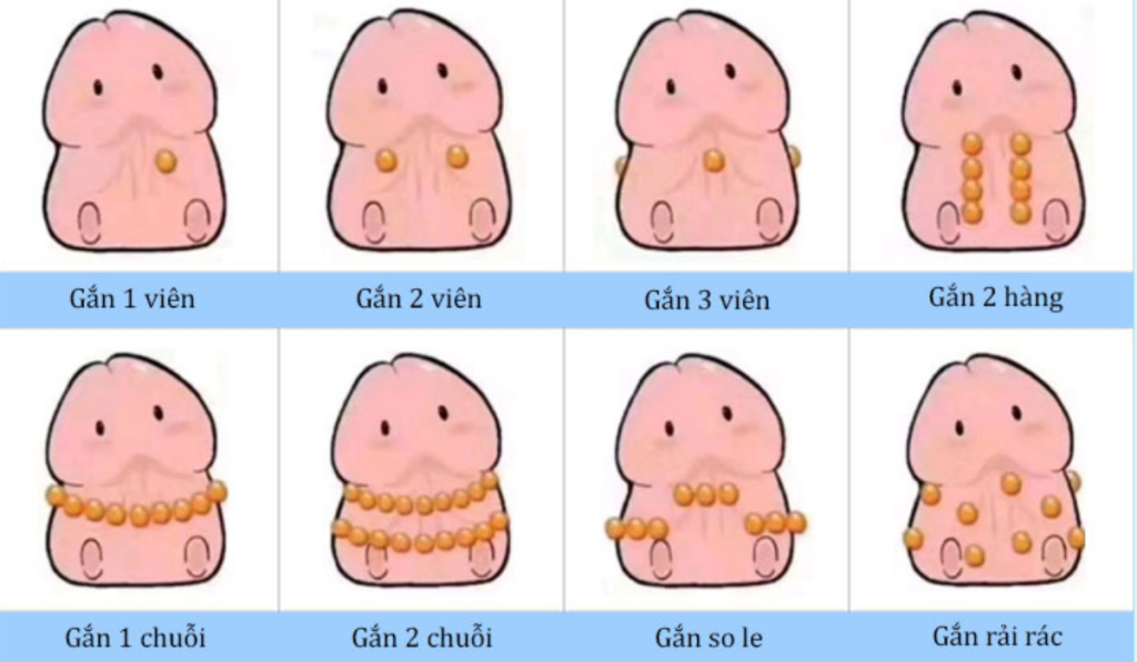 Tổng hợp hình ảnh gắn bi vào của quý nam giới
