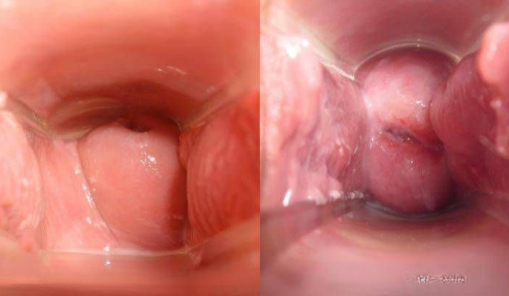 Hình ảnh ngứa vùng kín