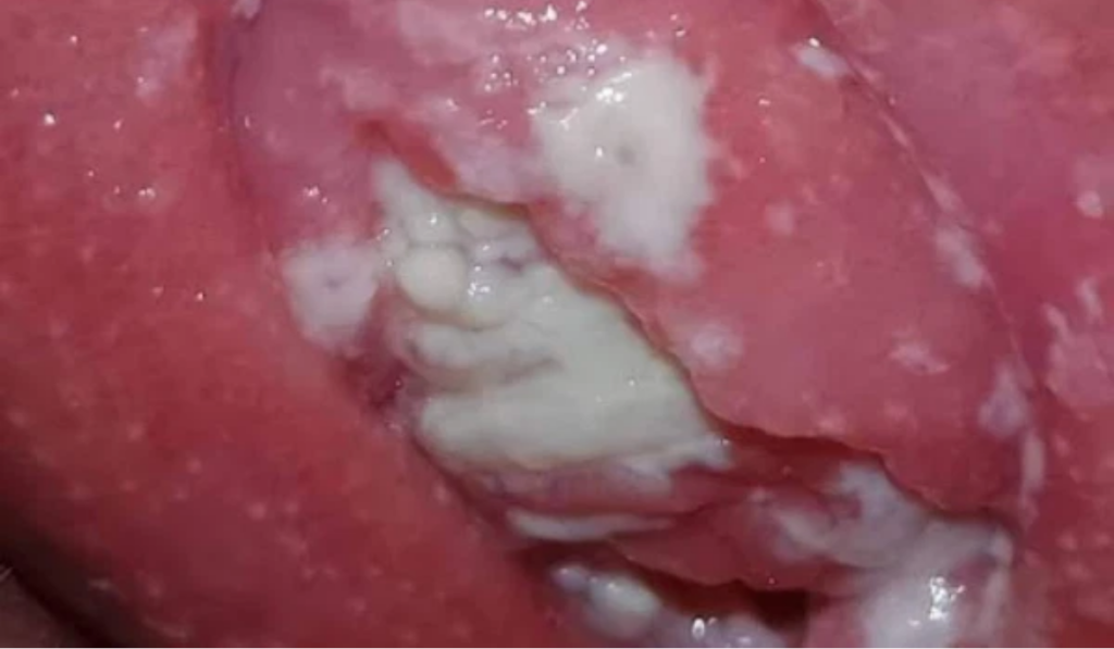 Thay đổi nội tiết tố và chế độ ăn uống