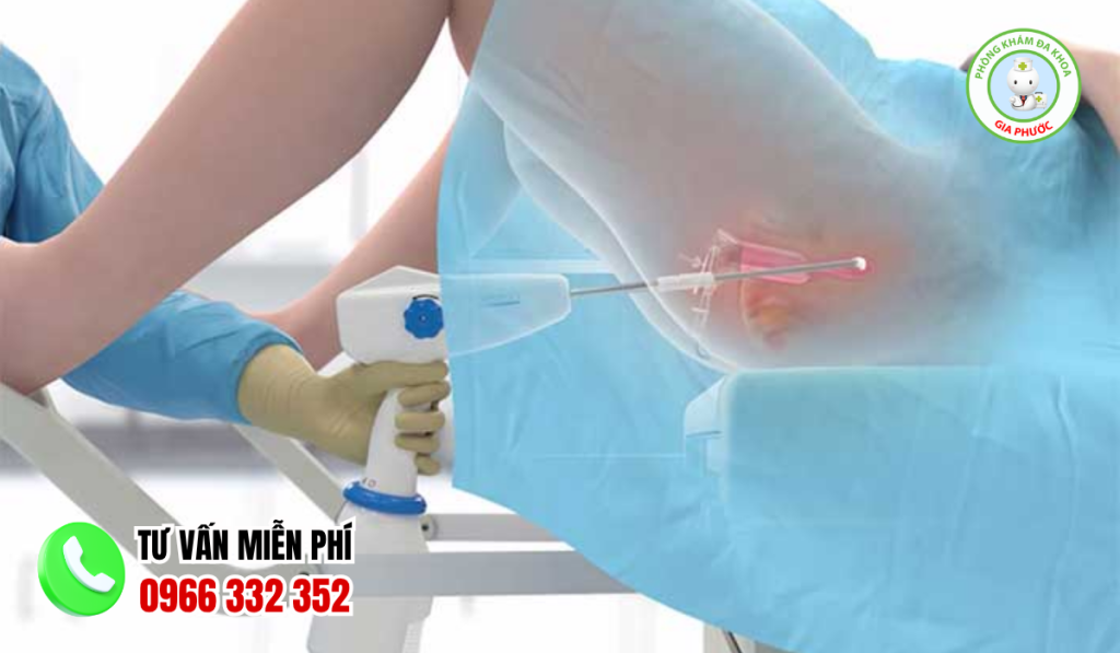 Đốt Viêm Lộ Tuyến Có Đau Không?