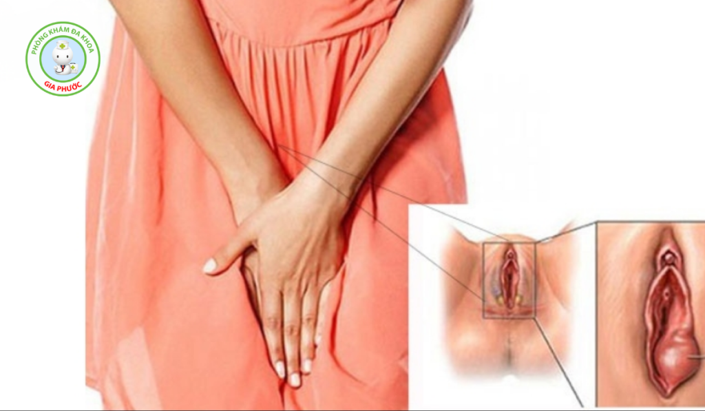 Hình ảnh môi bé bị phì đại