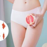 Hình ảnh môi bé phì đại