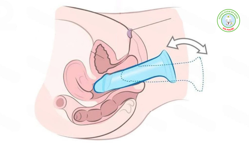Quan hệ chạm tử cung có sao không